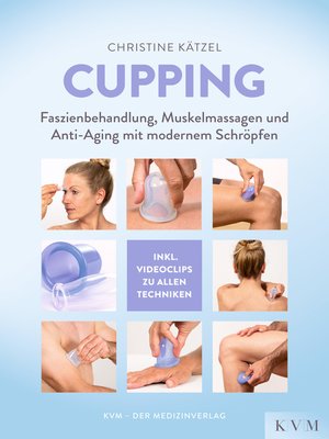 cover image of Cupping